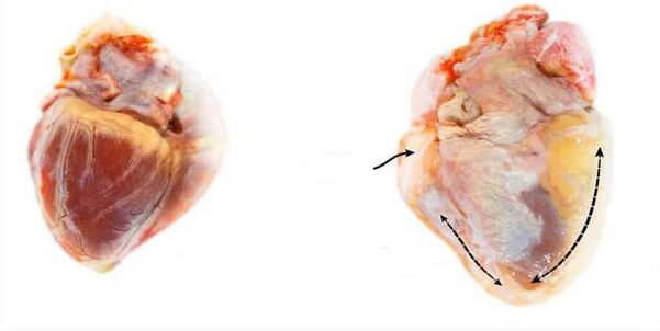 a healthy heart and an alcohol-affected heart